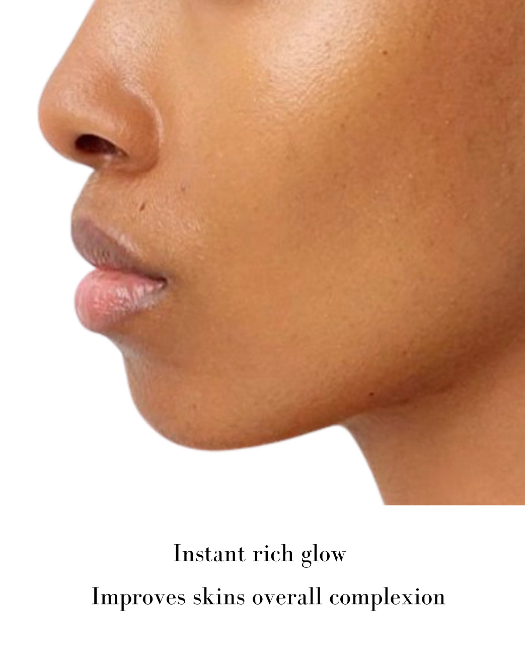 MISA - SERUM (FIRMS SKIN + RICH GLOW) Rose Hip - SOLD OUT